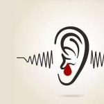 手淫撸管会导致耳鸣，耳鸣很复杂，可分为实证耳鸣和虚证性耳鸣